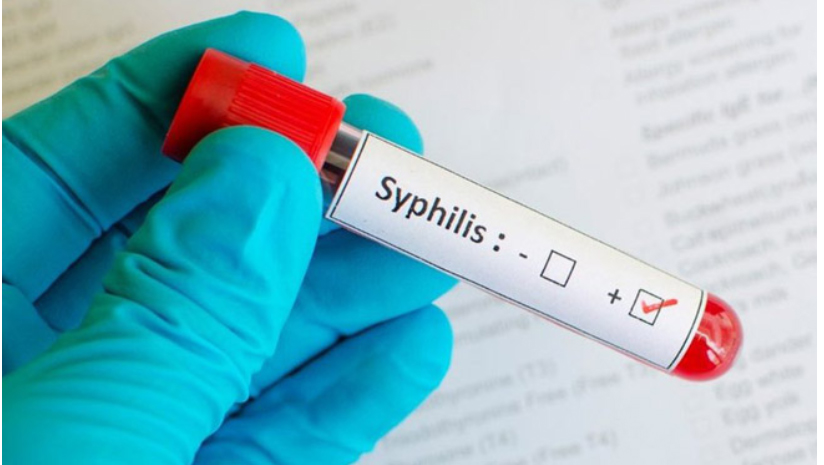 Sífilis una enfermedad con amor