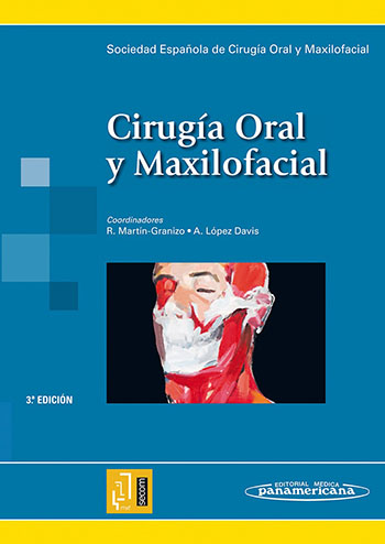 cirugia-oral-maxilofacial