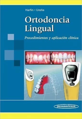 ortodoncia-lingual-harfin-D_NQ_NP_943085-MLA32388978822_102019-F