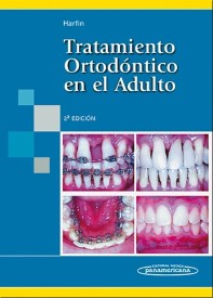 tratamiento-ortodontico-en-el-adulto